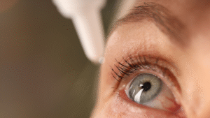 ojo seco evaporativo