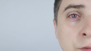 Ojo seco